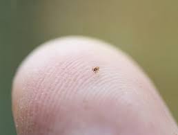 Image result for Tick Bite