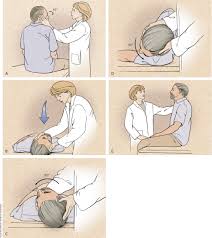 The goal of the canalith repositioning procedure (crp), a form of vestibular rehabilitation therapy, is to move the displaced canaliths to stop these false signals and the potential complications from this procedure include the possibility of neck/back injury or debris moving into another canal. Dizziness Approach To Evaluation And Management American Family Physician
