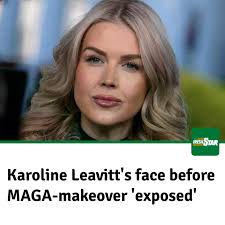 When discussing the notorious MAGA appearance, Karoline Leavitt certainly  fits the bill, but what might she look like without all the alleged lip  enhancements and heavy cosmetics?