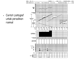 Maybe you would like to learn more about one of these? Pengisian Lembar Partograf