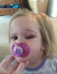 Dangers of bouncy beds for children's spine health