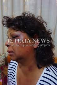 Συνεχής ενημέρωση για ότι συμβαίνει στην εύβοια και την στερεά ελλάδα. Skhniko Apisteyths Biaiothtas Sthn Eyboia Parea Andrwn Basanise Oikiakh Boh8o Eikones Ellada Iefimerida Gr