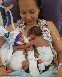 If babies are born any time before 37 weeks, they are considered premature. Woman Who Gave Birth To Twins At 29 Weeks Shares Photo Of Pair Meeting Daily Mail Online