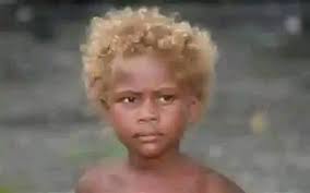 Blond haired black kids in Solomon Islands