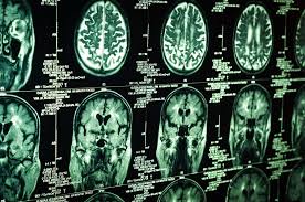 نتیجه جستجوی لغت [inoperable] در گوگل