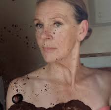 Can this photo be edited to remove dark spots?