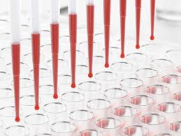 Gli anticorpi (o immunoglobuline nel caso fossero su un linfocita b vergine) sono una classe di glicoproteine del siero presenti nei vertebrati, il cui ruolo nella risposta immunitaria specifica è di enorme importanza. Tpo Alto E Tsh Normale C E Da Preoccuparsi Medicinalive