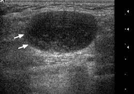 They might take images of your thyroid with an mri, ct scan, or ultrasound. Ultrasound Of Neck Lymph Nodes How To Do It And How Do They Look Sciencedirect