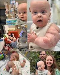 When Jenaya was 28 weeks pregnant, doctors found a strange mass on her baby's arm. At first, they thought it was harmless — but after months of tests and uncertainty, the truth