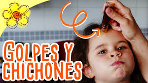 Aceite Para Golpes Y Chichones Youtube