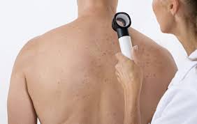 It occurs when unrepaired dna damage to skin cells triggers mutations, or people with very fair skin are extremely susceptible to skin damage from uv radiation, and therefore to developing skin cancer. Seven Subtle Skin Cancer Warning Signs That You Need To Know About The Irish News