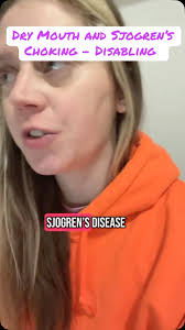 Sjogren’s disease is incredibly difficult to manage, and dry mouth is just  the tip of the iceberg., Dry mouth in Sjogren’s can lead to difficulty  talking, swallowing and increases the risk of a ...