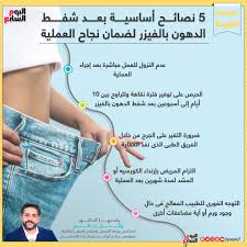 تأتي عملية شفط دهون البطن على رأس جراحات. Ø´ÙØ· Ø§Ù„Ø¯Ù‡ÙˆÙ† Ø¨Ø§Ù„ÙÙŠØ²Ø± 10 Ù†ØµØ§Ø¦Ø­ Ù‚Ø¨Ù„ ÙˆØ¨Ø¹Ø¯ Ø¥Ø¬Ø±Ø§Ø¡ Ø§Ù„Ø¹Ù…Ù„ÙŠØ© ÙŠÙ‚Ø¯Ù…Ù‡Ø§ Ø¯ÙƒØªÙˆØ± ÙˆØ§Ø¦Ù„ ØºØ§Ù†Ù… Ø§Ù„ÙŠÙˆÙ… Ø§Ù„Ø³Ø§Ø¨Ø¹