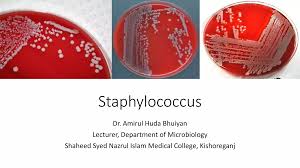 Image result for Staphylococcus Saprophyticus