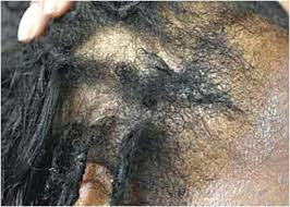 Pin Di Simple Hairstyle