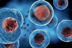 Closer To A Stem Cell Therapy For Huntington S Disease Results In Brief Cordis European Commission
