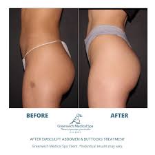 Emsculpt At Greenwich Medical Spa Medical Spa Medical Massage Body