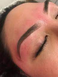 Use this solution twice every day for getting rid of white bumps. What To Do If Your Skin Rips Off During A Wax Waxing Tips From Dermatologists