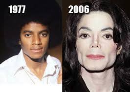 This Day In Rock History February 23 2003 The British Tabloid News Of The World Claims That Michael Jackson Has Had A Number Of Painf Plastic Surgery Celebrities Before After Michael Jackson