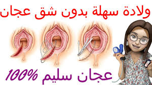 شق العجان جرح الولادة الطبيعية 10 نصائح ذهبية للتعافي بسرعة من جرح الولادة الطبيعية الغراز youtube