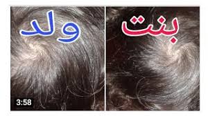 هتعرفي نوع جنينك من بريمه راس الطفل اللي قبله مضمونه وايه البريمه المفتوحه والمقفوله مع عقارب الساعه Youtube