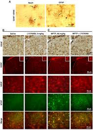 Dozens of bullish and bearish live candlestick chart patterns for the magazine luiza sa stock and use them to predict future market behavior. Activation Of Mglu3 Receptors Stimulates The Production Of Gdnf In Striatal Neurons