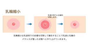 人に言えない…【乳輪肥大】の悩み｜平均サイズはどれくらい？乳輪縮小手術にまつわる疑問を医師が解説 | ヨガジャーナルオンライン