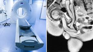 20 лет назад ученые впервые запечатлели секс с помощью МРТ - Газета.Ru