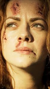 How did Michael Burn his back?