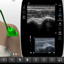 Image result for Biceps Tendon Injection