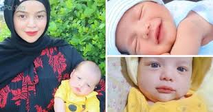 Doakan Bilal, Sakitnya Dah Makin Kronik." Derita Kepala Membesar Sehingga  28kg