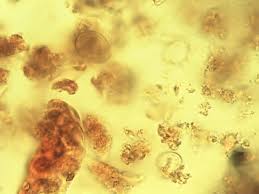 Image result for Ficus amadiensis