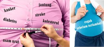 Hasil gambar untuk perut buncit