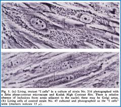 Lysosome Peroxisome Mitochondria Histology Flashcards Quizlet
