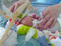 Delivery before 32 weeks' gestation may lead to severe neonatal morbidity and mortality. Timeo 11 Ans Ne Grand Premature