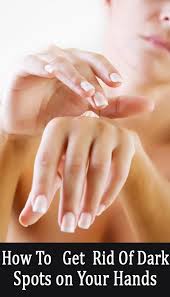 How To Get Rid Of Dark Spots On Your Hands Brown Spots On Hands Spots On Face Sunspots On Face