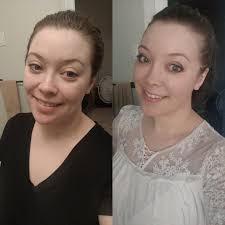 🔥🔥🔥🔥🔥🔥🔥🔥🔥🔥🔥🔥🔥🔥🔥🔥 The before and after photos show it all 🤩