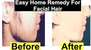 Hi, this bleach will not lighten the facial hair like a chemical bleach, it will only. How To Lighten Facial Hair At Home Painless Way Chemical Bleach Hennaandnailart Youtube