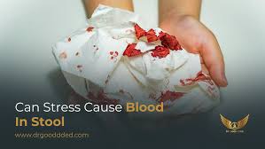 Image result for Blood in stool