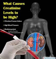 Reduce sodium intake in diet: What Causes Creatinine Levels To Be High Natural Ways To Lower It