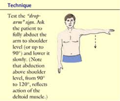 Image result for Drop Arm Test