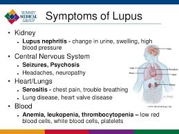 Lupus Nephritis Symptoms Lupus Nephritis Kidney Symptoms Lupus Awareness