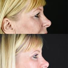 This is another one of Russell's...