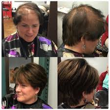 With 4 pressure sensitive clips, yo. Real Hair Toppers Near Me Off 78 Medpharmres Com