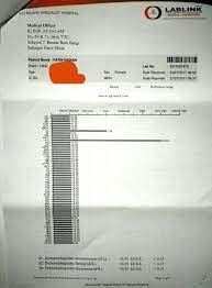 Private allergy tests cost £30 per allergen (plus the fee for taking a blood sample of £32.50) (excluding consultation fee and excluding recombinant allergens). Allergic Blood Test