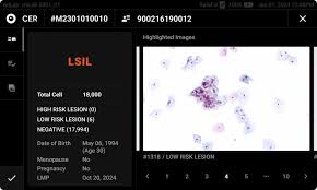 Image result for Friable Cervix