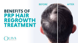 Paraben free presenting a product that will help you take care of your hair and scalp and prevent the hair problems from existing. Hair Loss Reasons And Regrowth Treatment In Telugu By Suma Kanakala Hyderabad Youtube