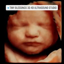 We have an 11:45, 2:00 & 3:00 available today! Call, text or PM to see your  sweet baby today 🤗