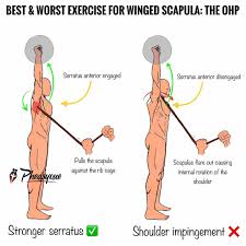 Image result for Winged Scapula