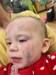 Falkville man indicted for 'striking' baby, family seeks justice